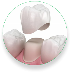 Dental Crowns 006