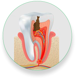 Dental Crowns 007