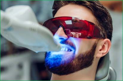 Teeth Whitening 001